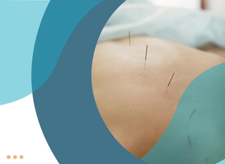 Βελονισμός (Dry Needling)